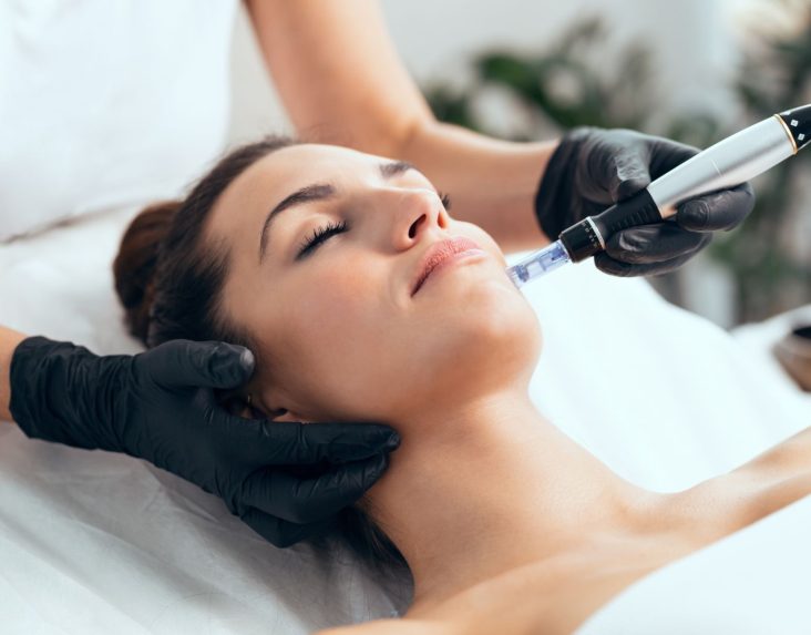 Microneedling