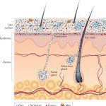 Μικροβίωμα και Φλεγμονώδεις Δερματικές Παθήσεις: Τι Πρέπει να Γνωρίζετε!