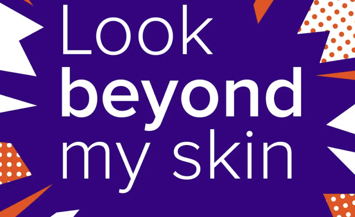 psoriasis